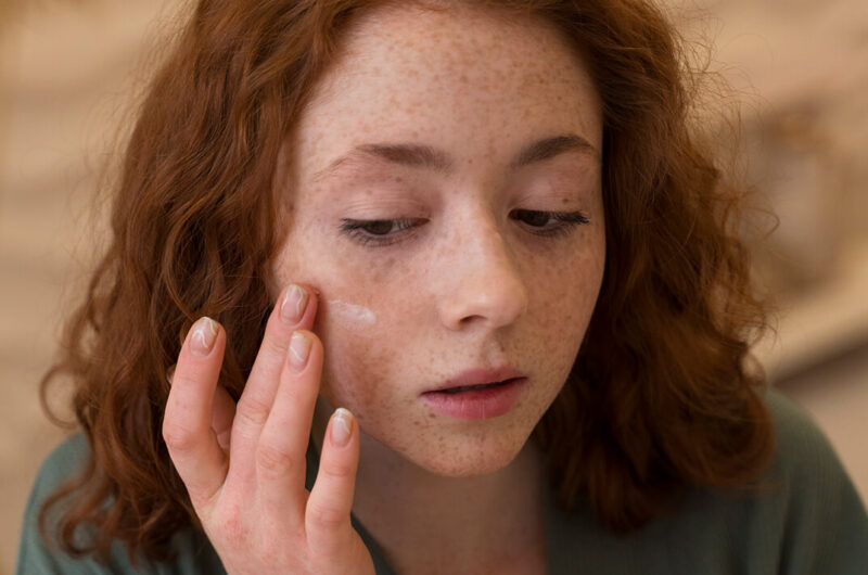 Laser treatments