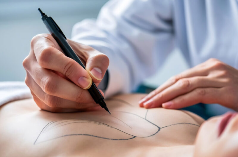 Surgical Oncolog